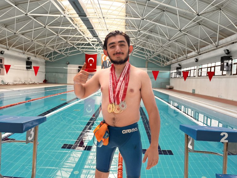 Türkiye birincilikleri bulunan cam kemik hastası yüzücünün hedefi dünya şampiyonluğu1
