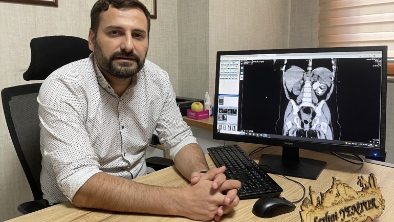 ELAZIĞ - 13 aylık bebeğin böbreğindeki 5 santimetrelik taş ameliyatla çıkarıldı1