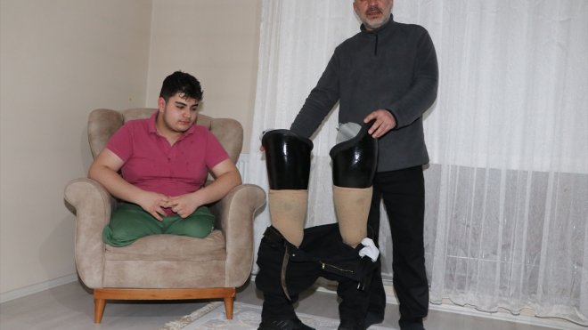 Doğuştan iki bacağı olmayan Miraç, küçülen protezlerinin yenilenmesini istiyor