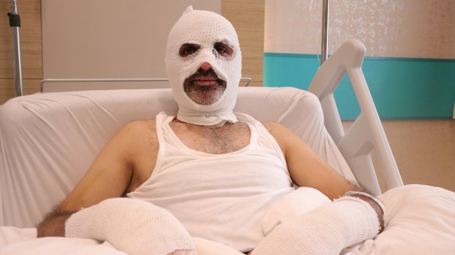 Grip yüzünden gaz kaçağını fark etmediği tüpü yakınca canından oluyordu