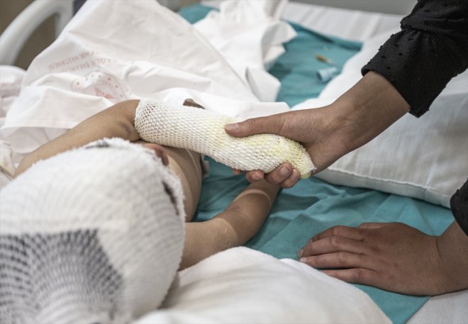 yangında - kuzenlerin Evde tedavisi yaralanan film çizgi çıkan izlerken sürüyor ERZURUM 2