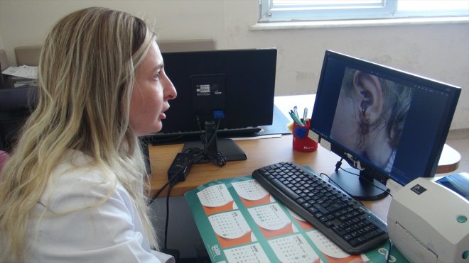 Bitlis'te 3 yaşındaki çocuğun kulağından 23 sinek larvası çıkarıldı