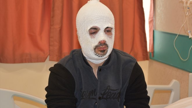 Erzurum'da piknik tüpünün alev almasıyla yüzü yanan tır şoförünün tedavisi sürüyor