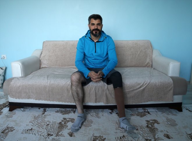 Ayağı 5 yaşındayken kesildi, sporla hayata tutundu