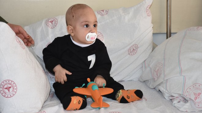 Van'da 7 aylık bebeğin kafatasındaki şekil bozukluğu 5 saatlik ameliyatla giderildi