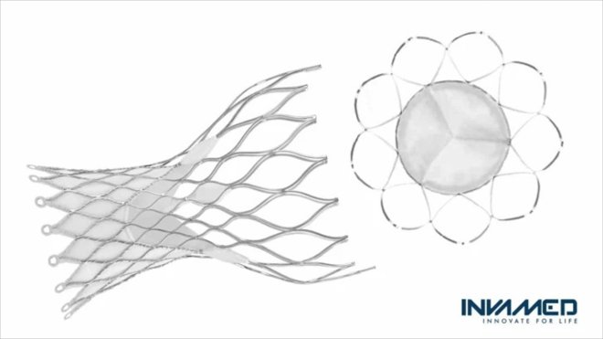 INVAMED kalp kapağı üretti1