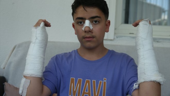 Kars'ta sahipsiz köpeğin saldırdığı çocuk yaralandı