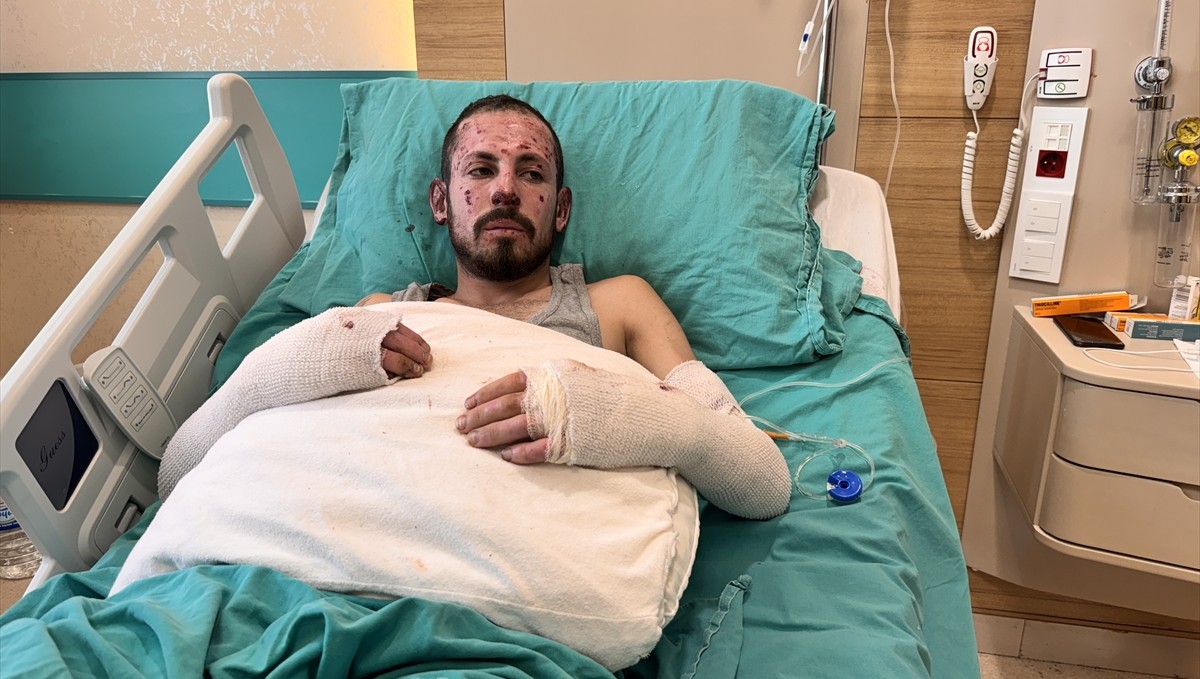 Nişan telaşıyla buji arızasını gidermediği aracında çıkan yangında hastanelik oldu