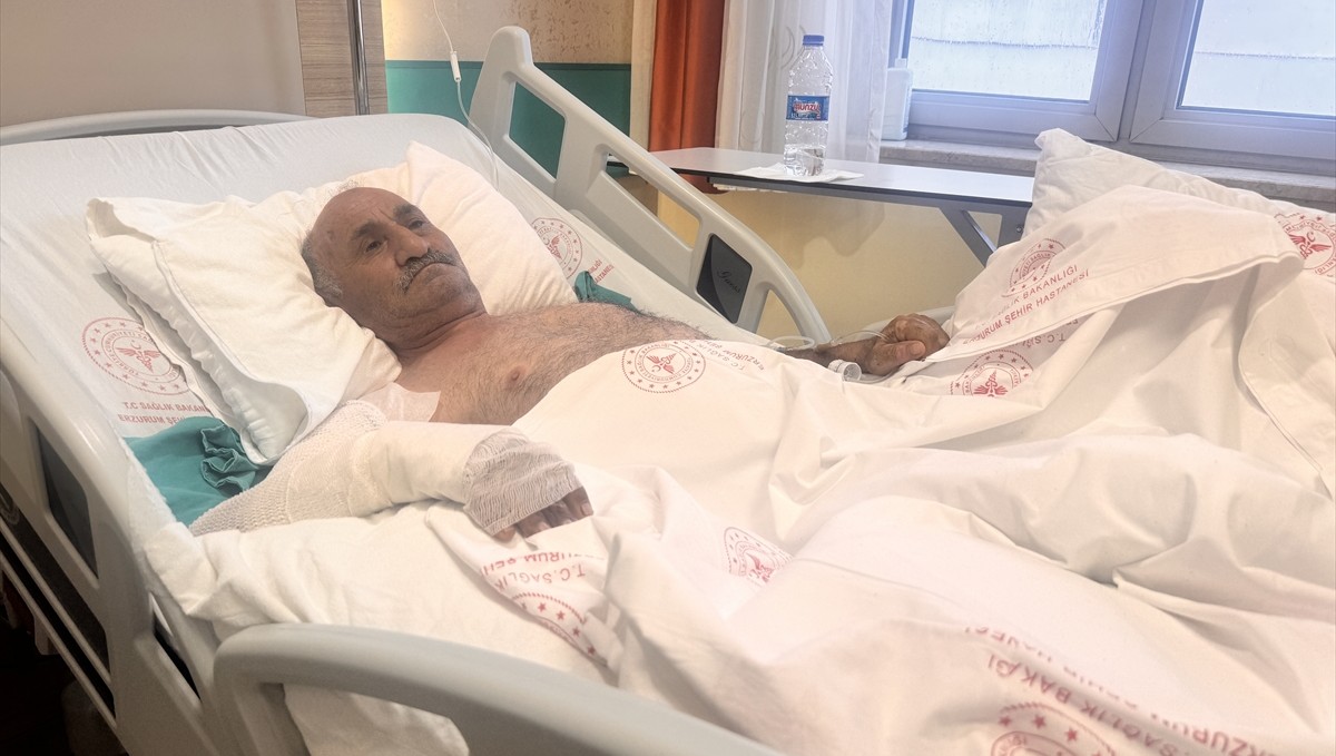 Ateş bulunan ortamda hızara benzin koymaya çalıştı, vücudunun yüzde 35'i yandı