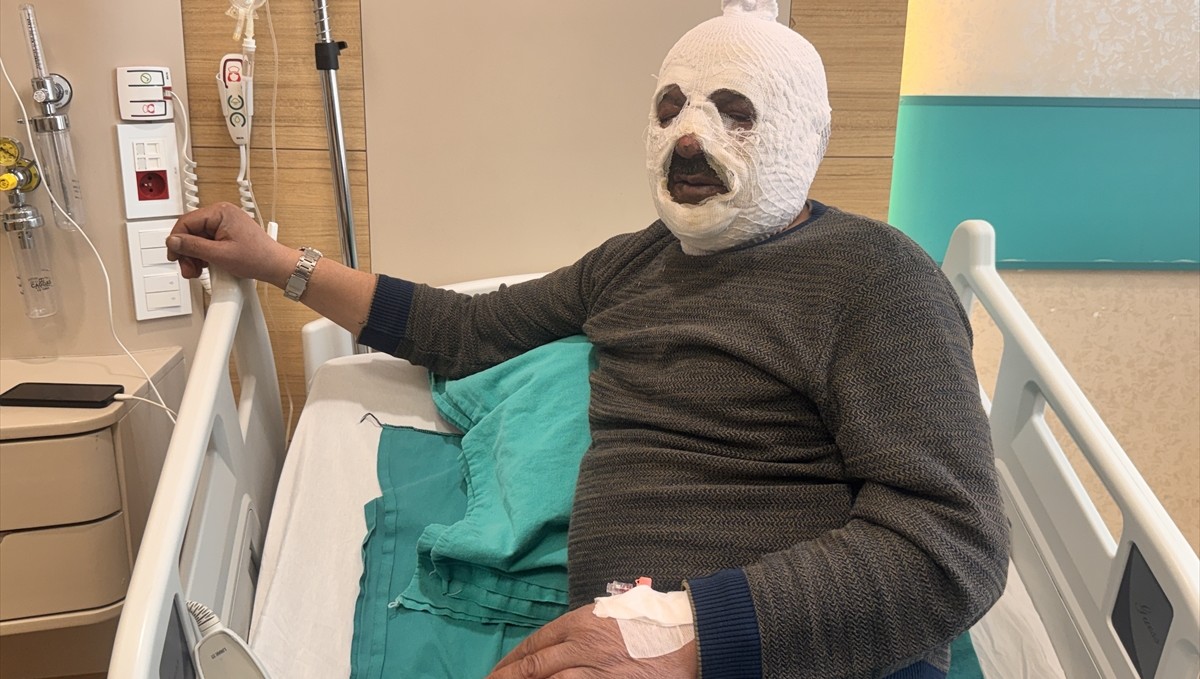 Kalorifer kazanını yakmak için döktüğü benzin az daha canından ediyordu